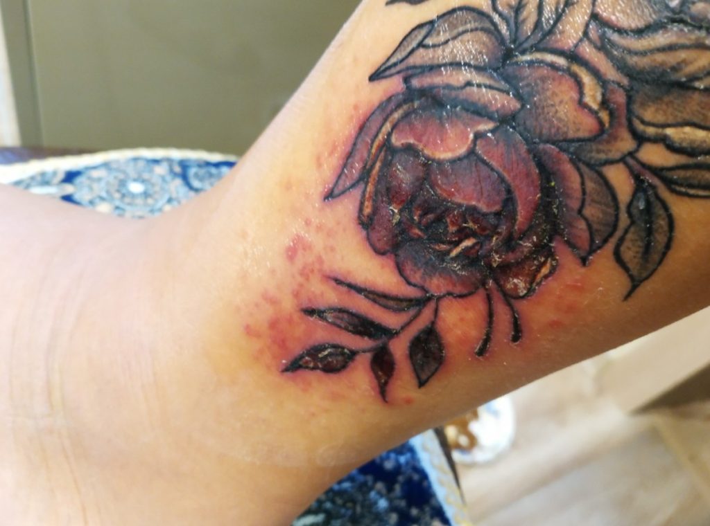 Tatovering: hvilken uventet reaktion kan huden have på motivet