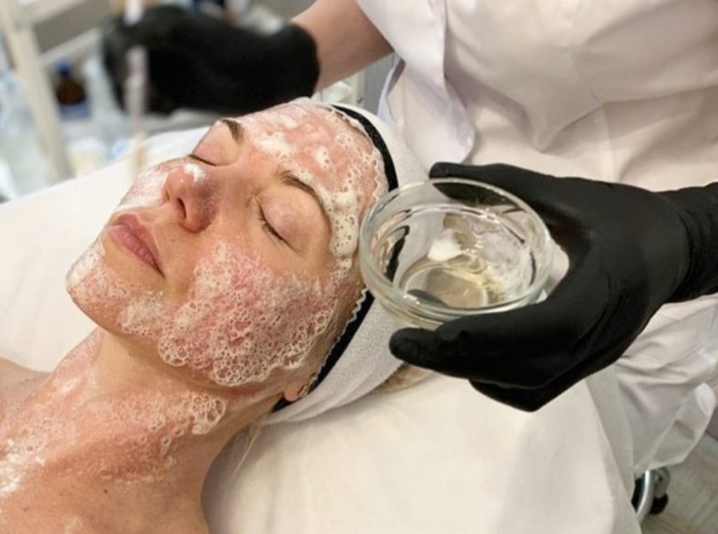 Sådan laver du en kemisk peeling derhjemme: nyttige tips